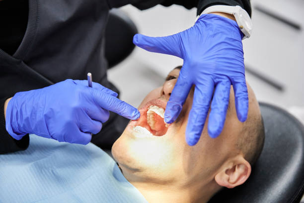 Best Emergency Wisdom Teeth Removal in Guadalupe, CA